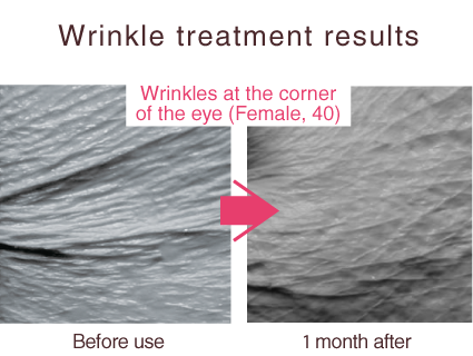 シワ改善効果を発表